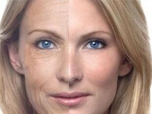 pigmentación de la piel