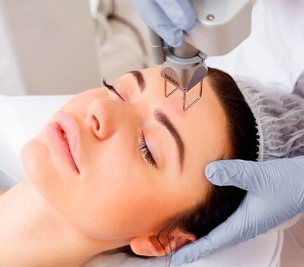 La esencia de la cirugía de rejuvenecimiento facial con láser fraccionado