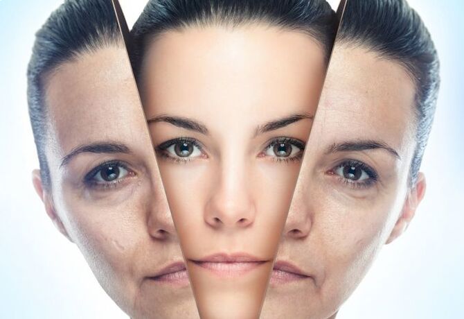 El proceso de eliminar los cambios relacionados con la edad en la piel del rostro. 